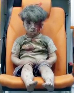 Syrian child, Omran Daqneesh